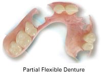 partial flexible dentures