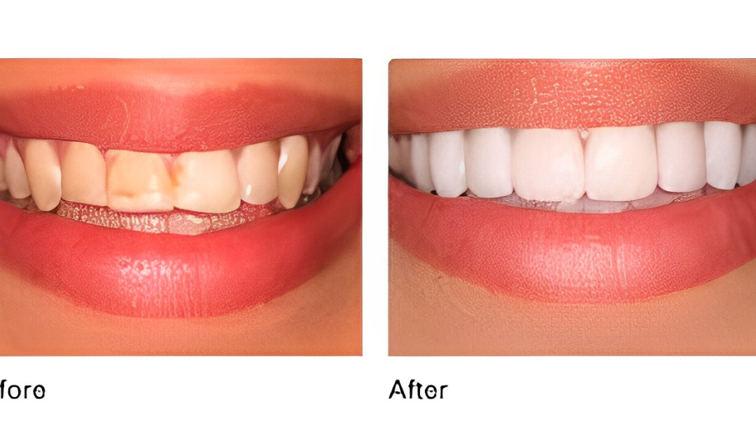 Enhance Your Smile and Boost Your Confidence with Cosmetic Dentistry Melville NY